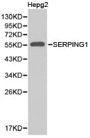 Polyclonal Rabbit anti-Human SERPING1 / C1 Inhibitor Antibody (IF, WB)