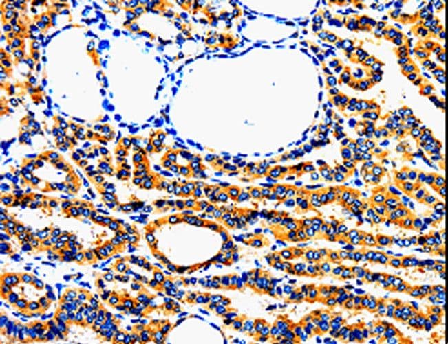 AIMP2 Antibody
