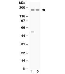 CP / Ceruloplasmin Antibody