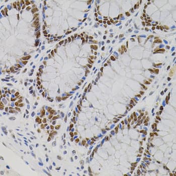 Polyclonal Rabbit anti-Human AKAP8 / AKAP95 Antibody (AP, IHC, WB)