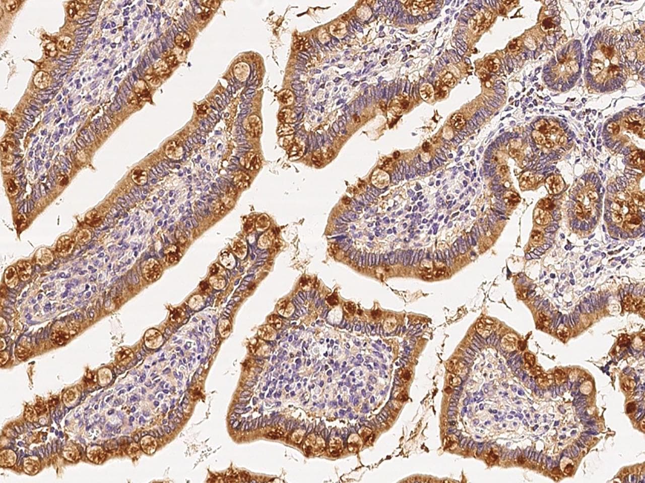RAB1A Antibody (Preservative Free)