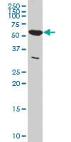 Monoclonal Mouse anti-Human PKM / Pyruvate Kinase, Muscle Antibody (clone 5D2-3B3, WB)