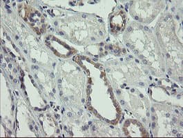 NNA1 / AGTPBP1 Antibody (clone OTI9A3)