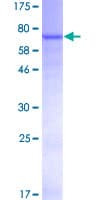 Human PNLIPRP2 Protein (Recombinant GST)