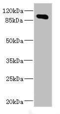 Polyclonal Rabbit anti-Human MAP4K5 Antibody (IHC, WB)