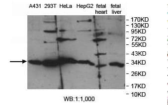 PPA1 Antibody (aa125-270)