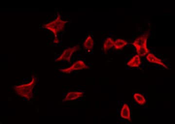 MMP3 Antibody