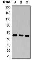IL2RA / CD25 Antibody (Internal)