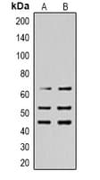 Polyclonal Rabbit anti-Human p66 / SHC Antibody (phospho-Tyr427, IHC, WB)