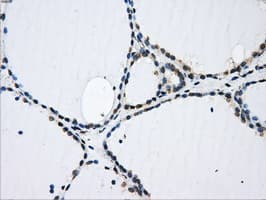 GBE1 Antibody (clone OTI5B7)