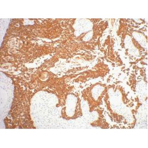 KRT16 / CK16 / Cytokeratin 16 Antibody (clone 6F6)