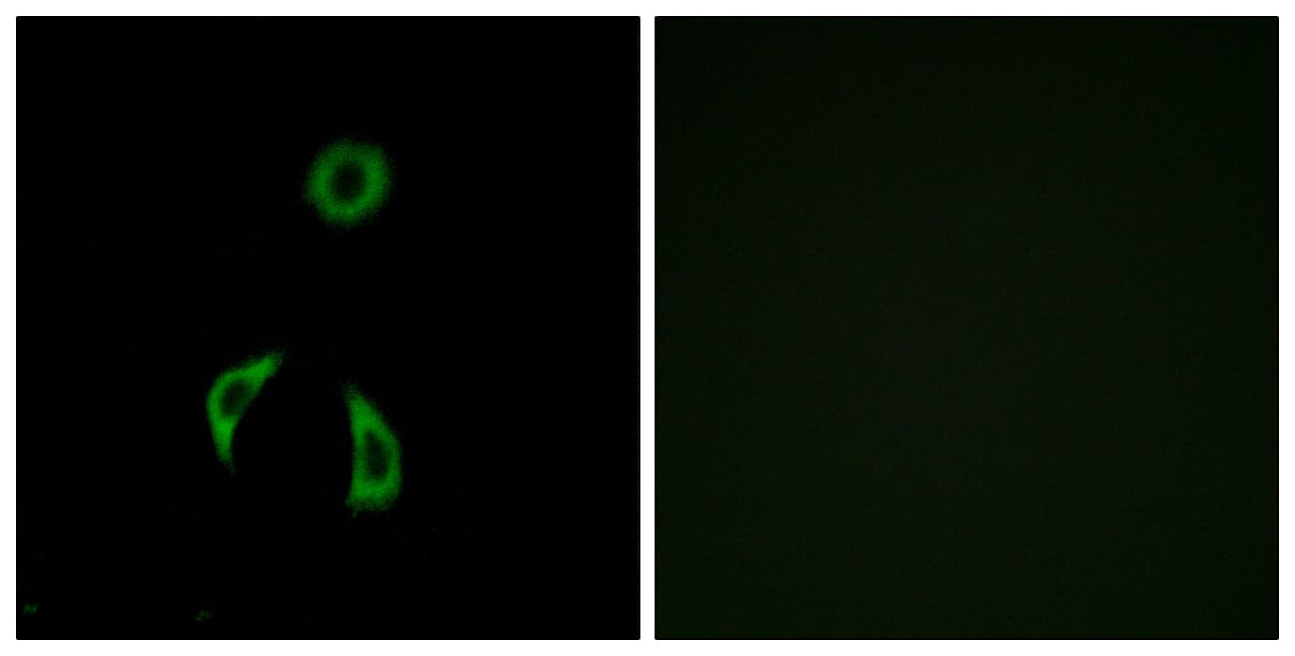 IHC-plus™ Polyclonal Rabbit anti-Human FZD3 / Frizzled 3 Antibody (aa481-530, IHC, IF, WB)