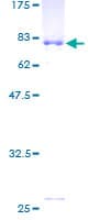 Human Zfp105 / ZNF35 Protein (Recombinant GST)