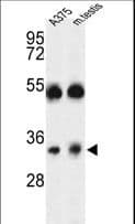 TMEM142A / ORAI1 Antibody (aa145-173)