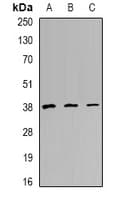 TREX1 Antibody