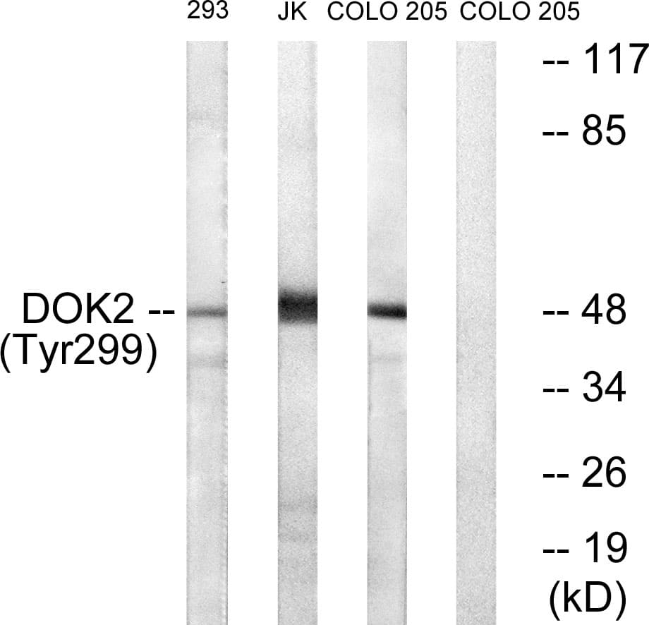 DOK2 Antibody (phospho-Tyr299)