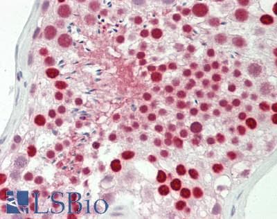 IHC-plus™ QIP1 / KPNA4 Antibody (aa471-521)