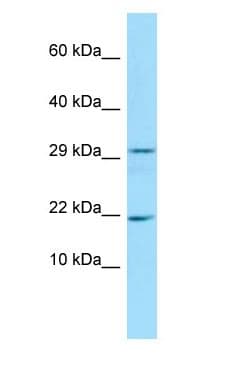 FANCD2OS Antibody (N-Terminus)