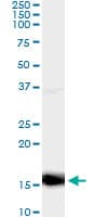 CXCL4 / PF4 Antibody (clone 3F6)