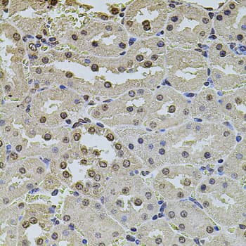 POT1 Antibody
