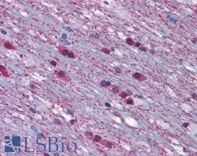 PathPlus™ ADRA1A Antibody (Cytoplasmic Domain)