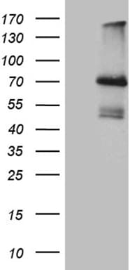 IL2RB / CD122 Antibody (aa27-240+Mouse, clone OTI1D1)