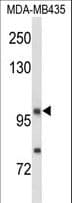 NRP1 / Neuropilin 1 Antibody (aa722-750)