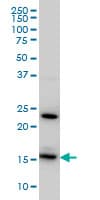 IHC-plus™ RPS17 / Ribosomal Protein S17 Antibody (clone 2C7)