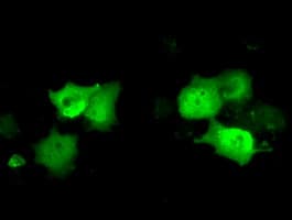 C21orf59 Antibody (clone OTI2H5)