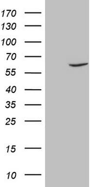 Monoclonal Mouse anti-Human FSCN1 / Fascin Antibody (clone OTI3B4, IHC, WB)
