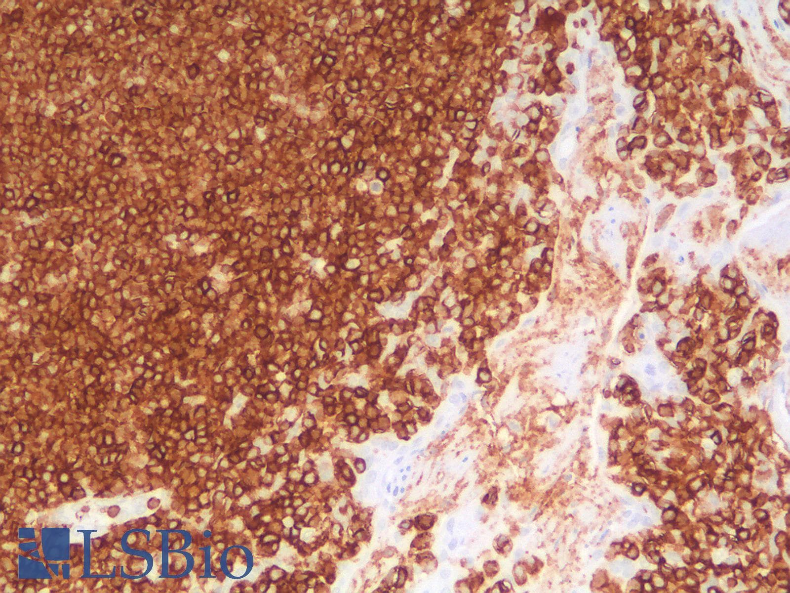 PathPlus™ Recombinant Monoclonal Rabbit anti-Human CD45 / LCA Antibody (clone PTPRC/1975R, IHC, WB)