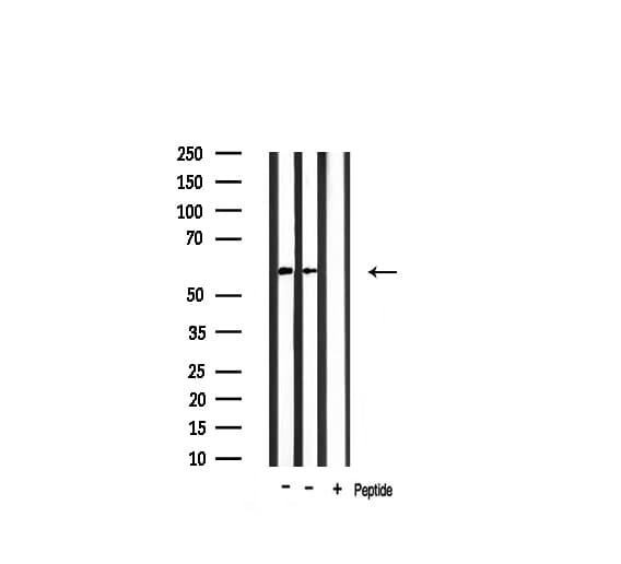 KRT10 / CK10 / Cytokeratin 10 Antibody