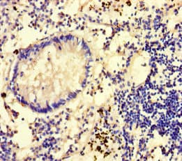 GLCE Antibody