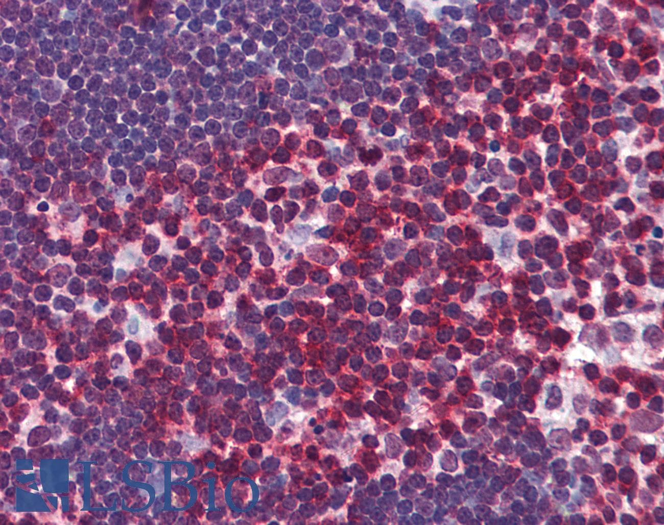 IHC-plus™ Monoclonal Mouse anti-Human CD247 / CD3 Zeta Antibody (clone 4A12-F6, IHC, WB)