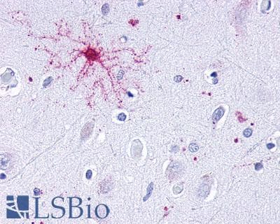 PathPlus™ Leukotriene B4 Receptor / BLT1 Antibody (C-Terminus)