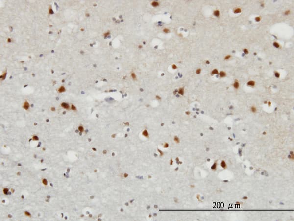 FGF12 Antibody (clone 1D9)