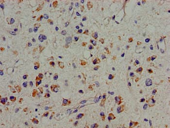 PTK2B / PYK2 Antibody