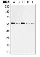 KRT10 / CK10 / Cytokeratin 10 Antibody (Internal)