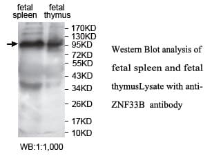 ZNF33B Antibody (aa302-556)