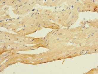 CACNA2D4 Antibody