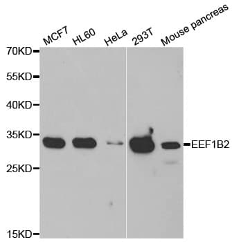 EF1B / EEF1B2 Antibody