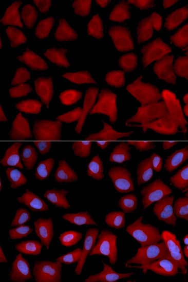 Polyclonal Rabbit anti-Human PSMC4 Antibody (IHC, IF, WB)