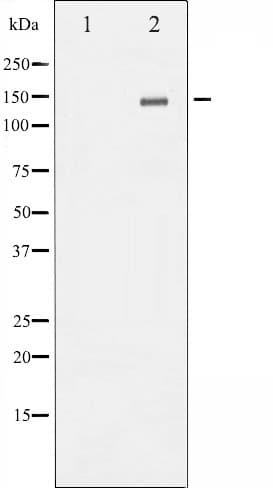 c-Met Antibody