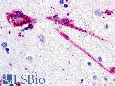 PathPlus™ C5AR2 / GPR77 / C5L2 Antibody (Extracellular Domain)