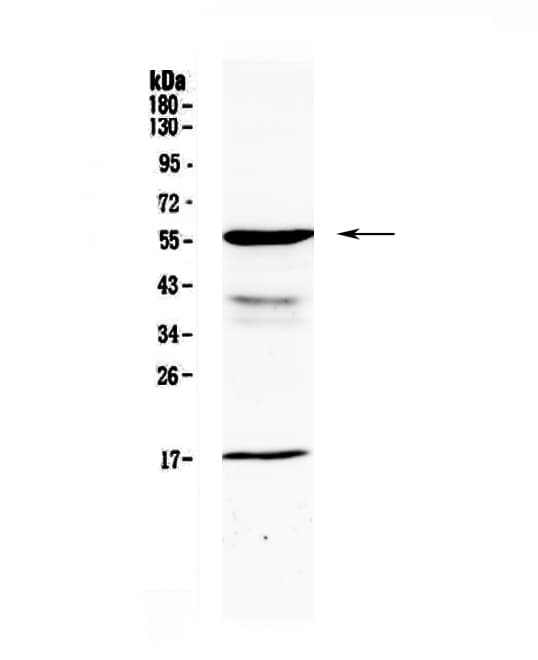 GALNS / Chondroitinase Antibody