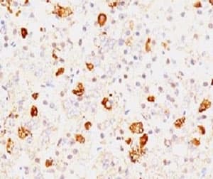 FSHB / FSH Beta Antibody (clone FLTPb-1, Ready-to-Use)