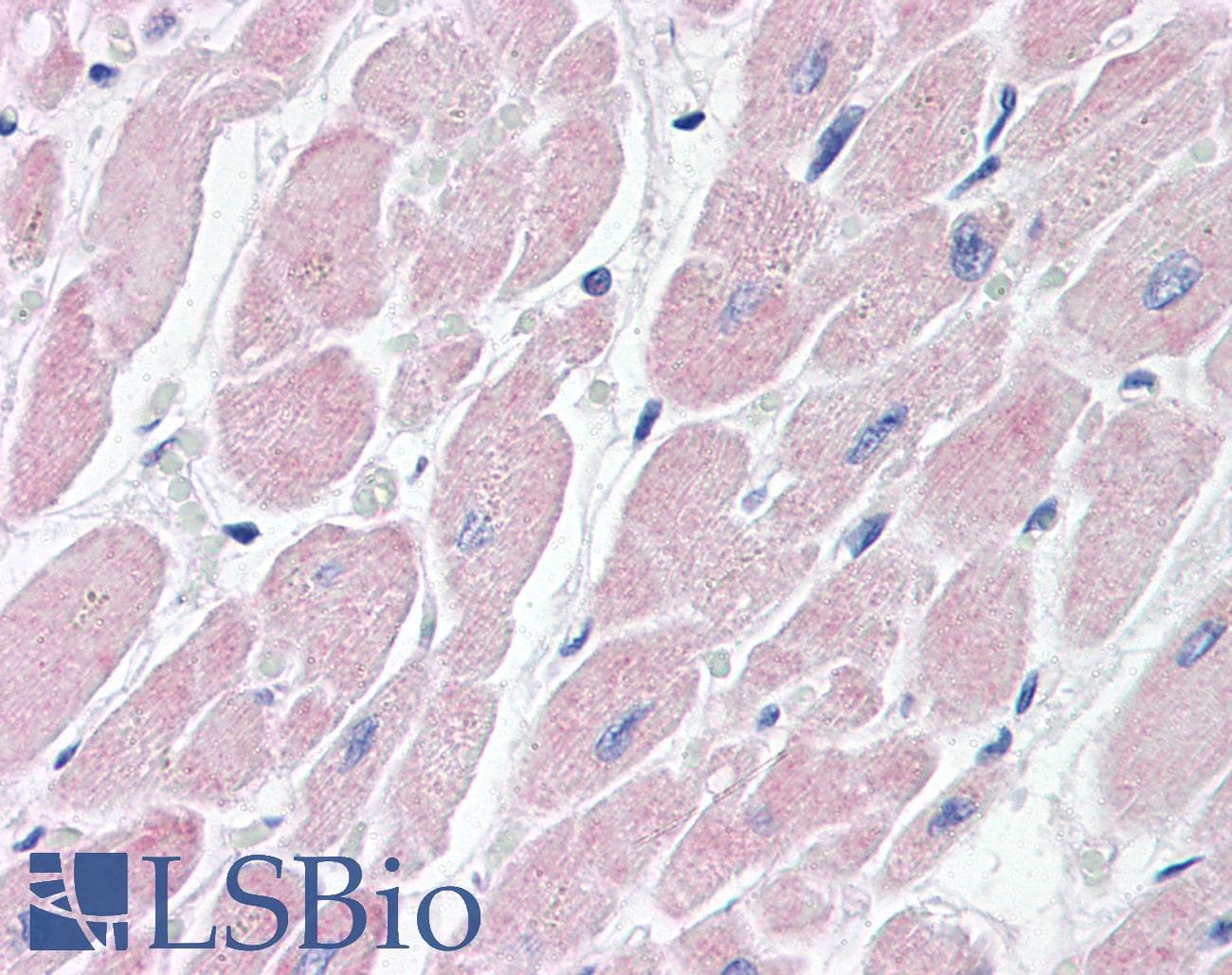 IHC-plus™ ADGRB3 / BAI3 Antibody (aa1506-1522)