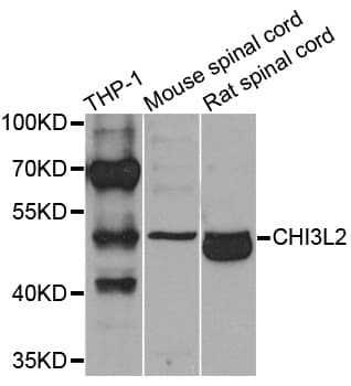 YKL39 / CHI3L2 Antibody