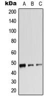 Polyclonal Rabbit anti-Human ADRB2 Antibody (phospho-Ser346, WB)