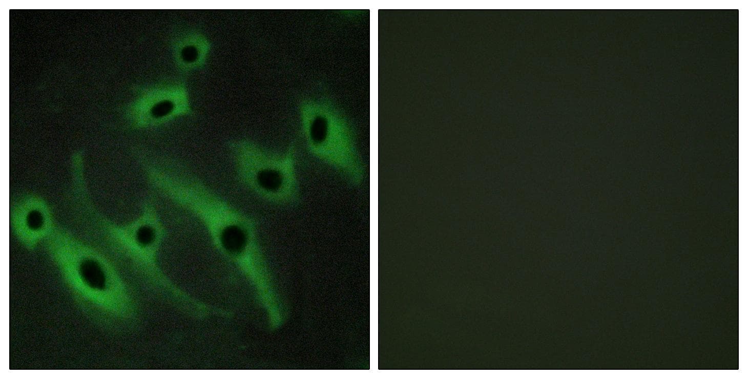ERBB2 / HER2 Antibody